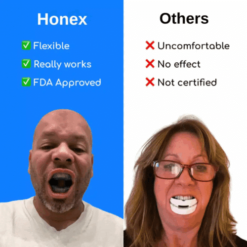 Honex Anti-snoring Mouthpiece (official Retailer) 2025