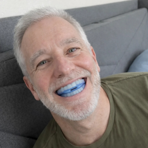 Honex Anti-Snoring Mouthpiece (Buy 1 Get 1 Free)